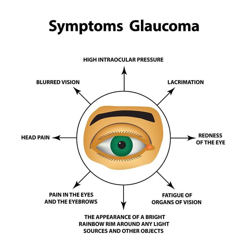 Symptoms of Glaucoma diagram