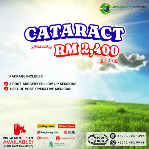 Cataract surgery package promotion